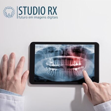studio/rx-futuro-imagens-digitais-odontologicas
