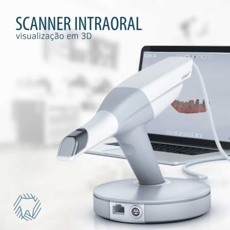 scanner-intraoral-blog