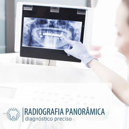 radiografia-panoramica-diagnosticopreciso-blog