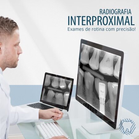 radiografia-interproximal-exames-precisao