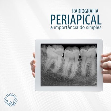 radiografia-periapical-importancia-simples