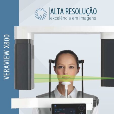 tomografo-veraview-x800-morita-tecnologia