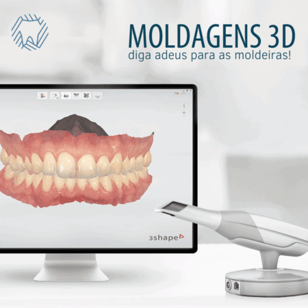 scanner-intraoral-moldagem-3d