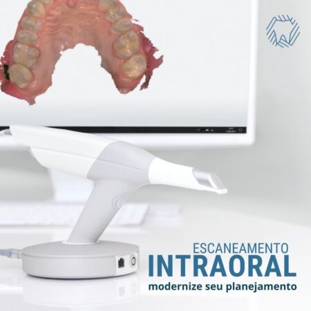 escaneamento-intraoral