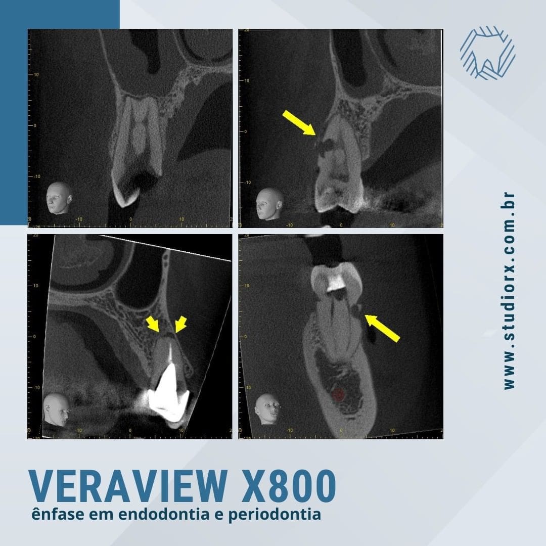 veraview-x800