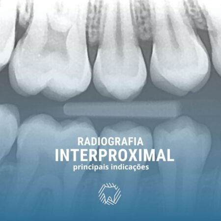 radiografia-interproximal
