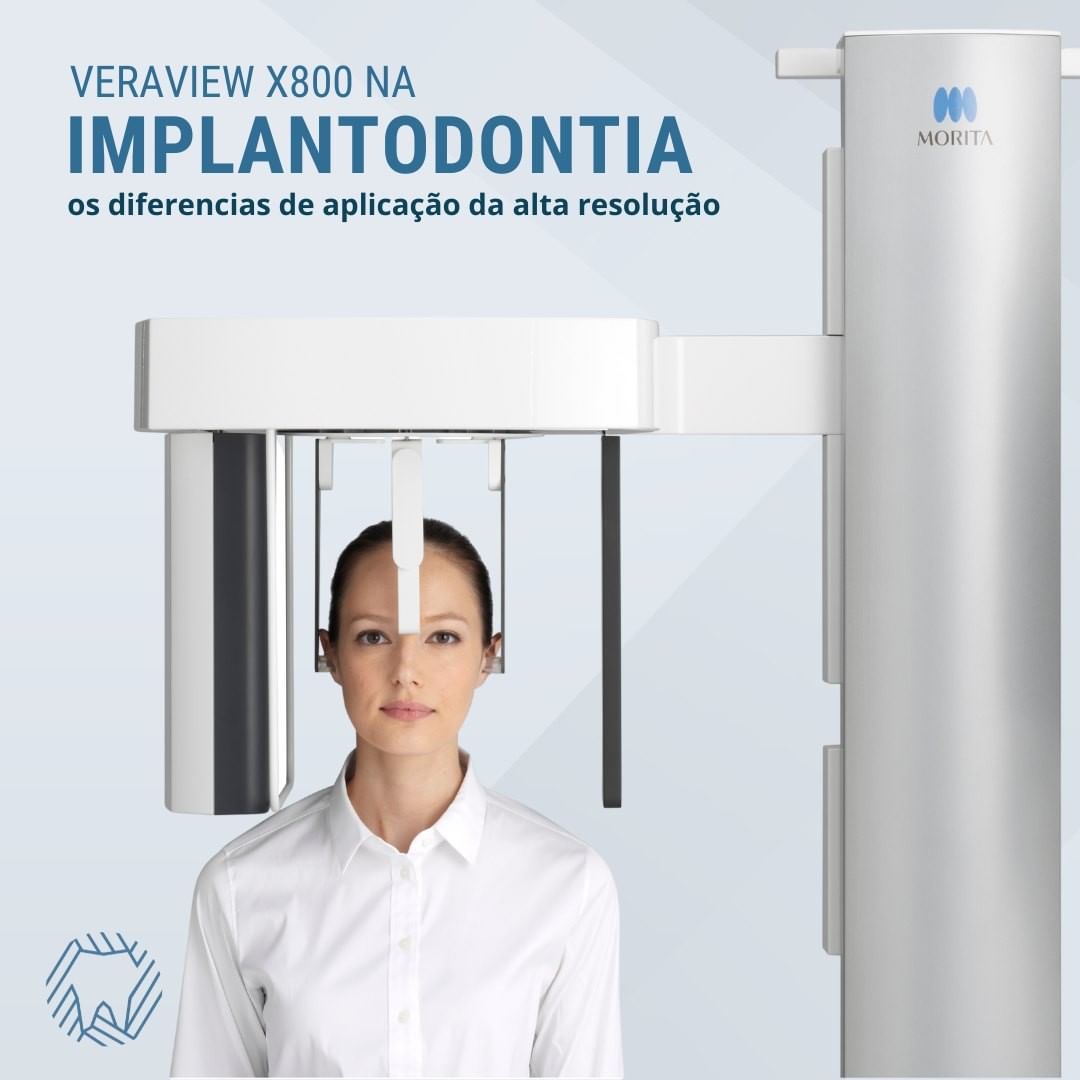 implantodontia