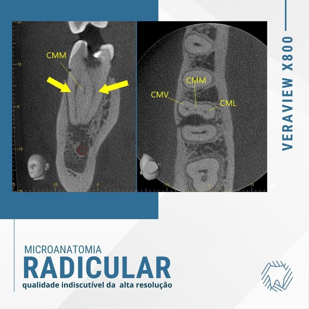 microanatomia-radicular