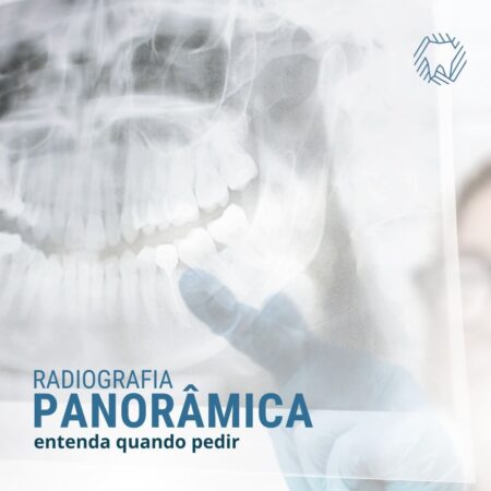 radiografia-panoramica