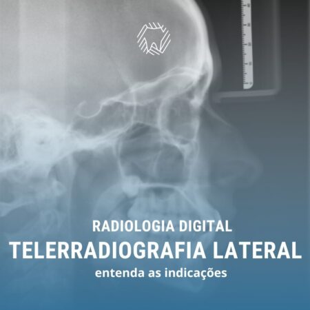 telerradiografia-lateral
