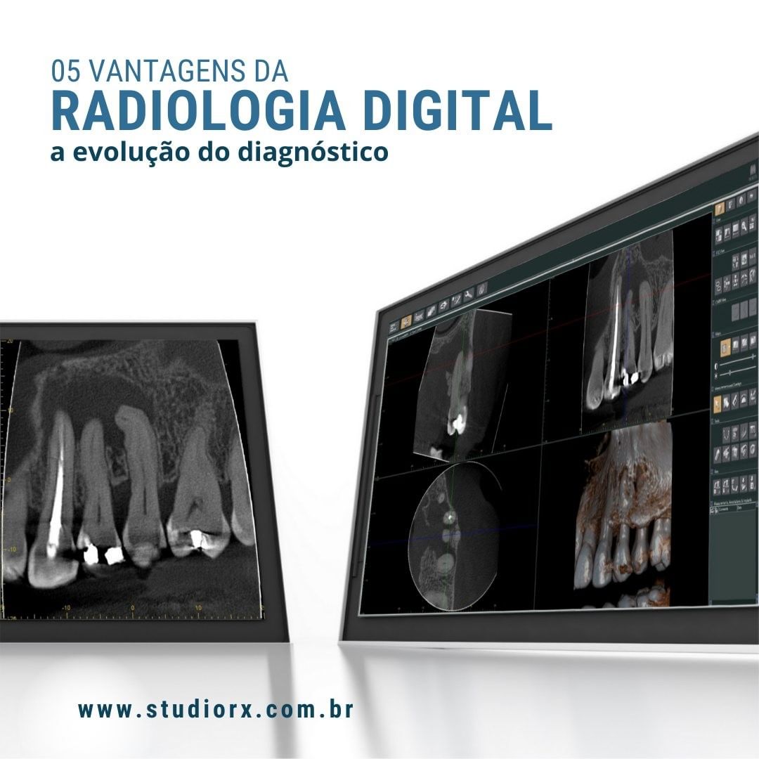 radiologia-digital