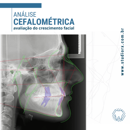 analise-cefalometrica