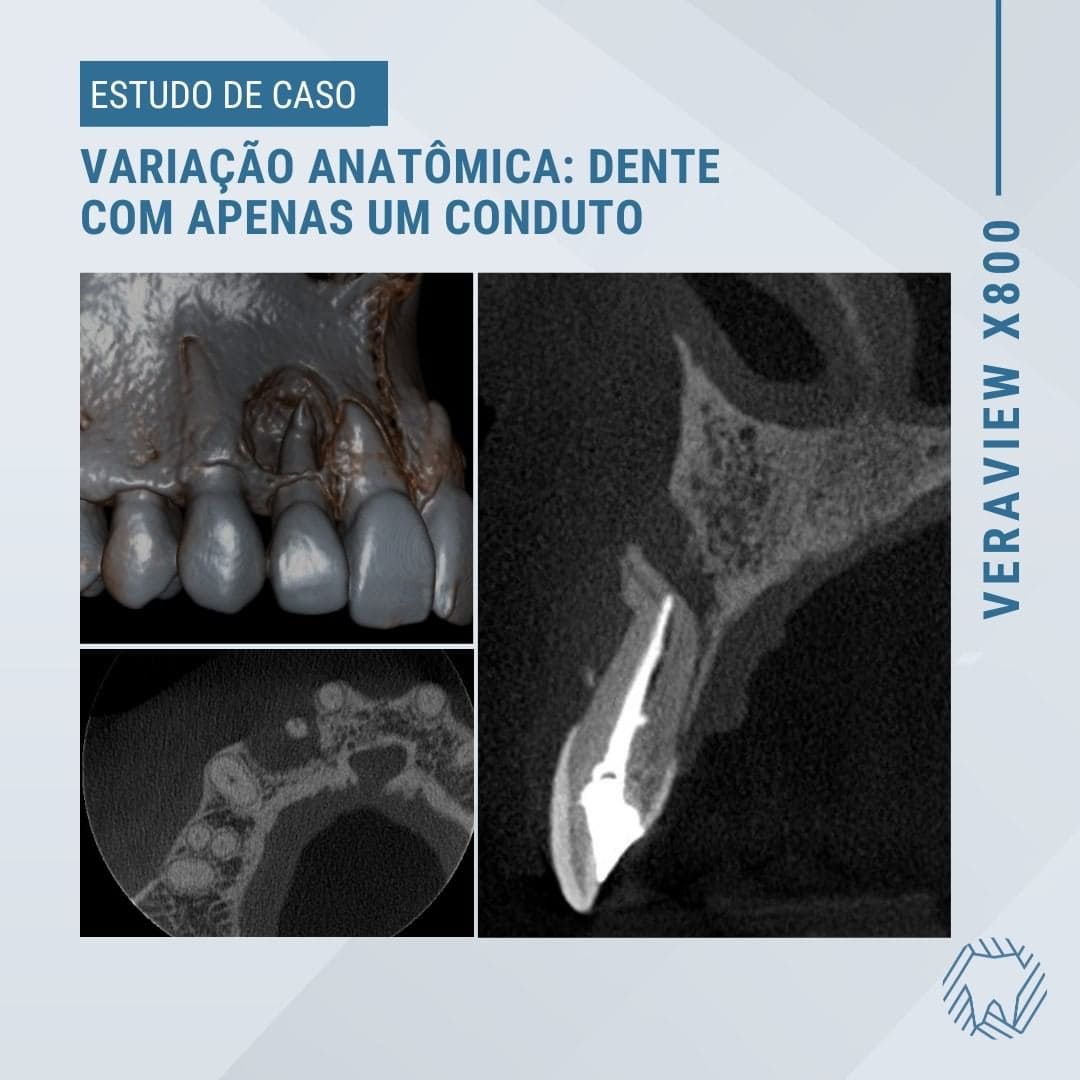 variacao-anatomica