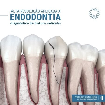 endodontia