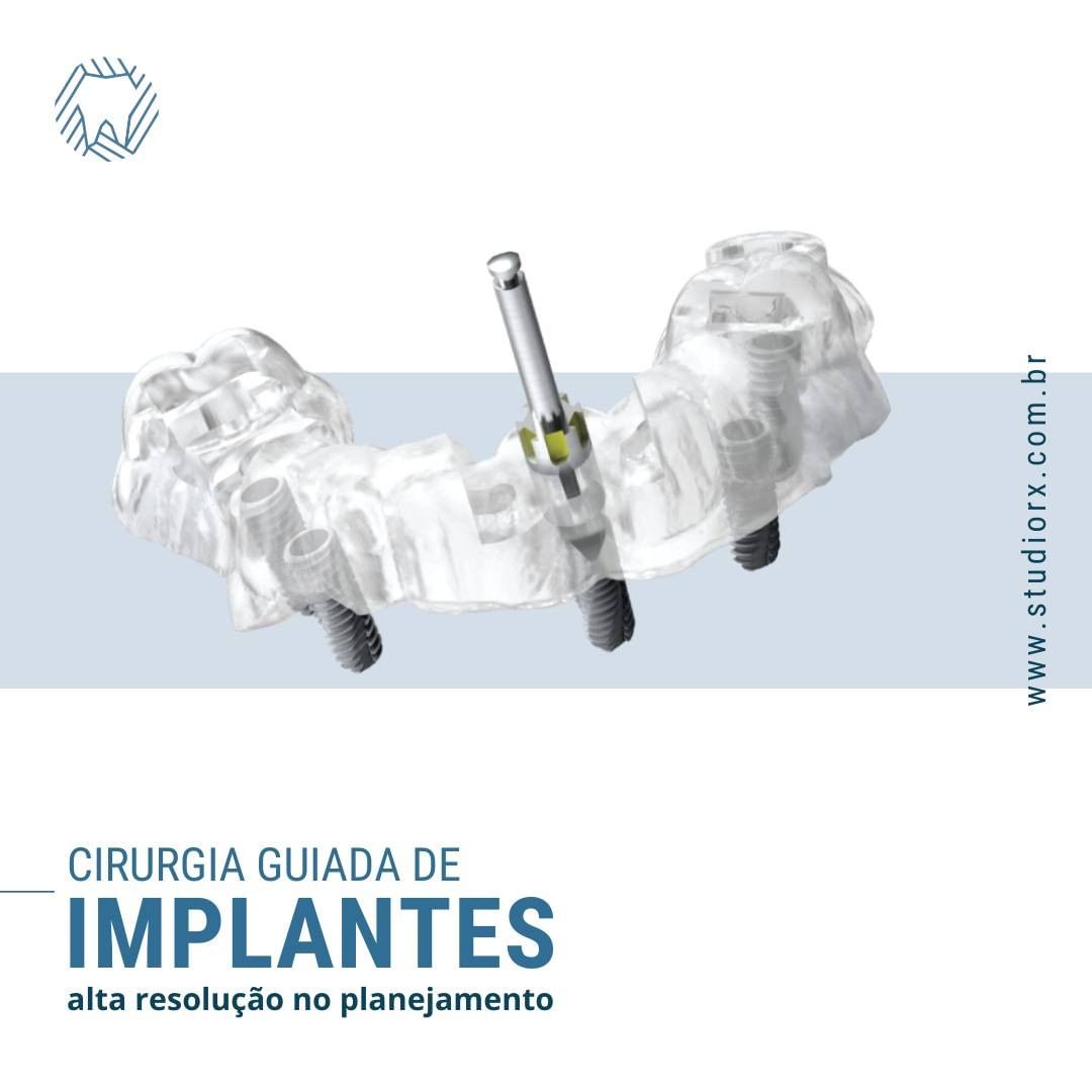 cirurgia-guiada