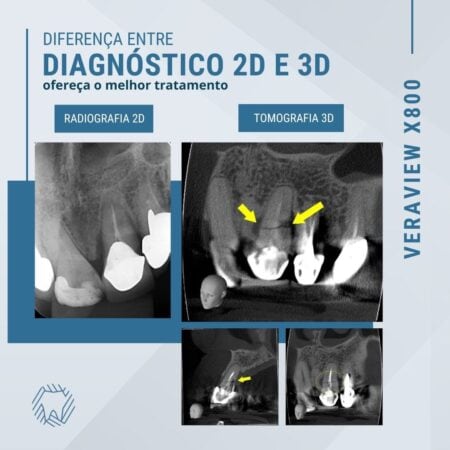 diagnostico-2d-e-3d