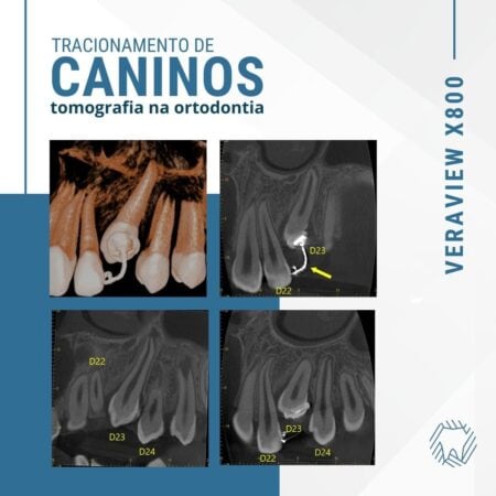 tomografia-na-ortodontia