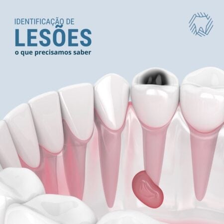 identificacao-de-lesoes