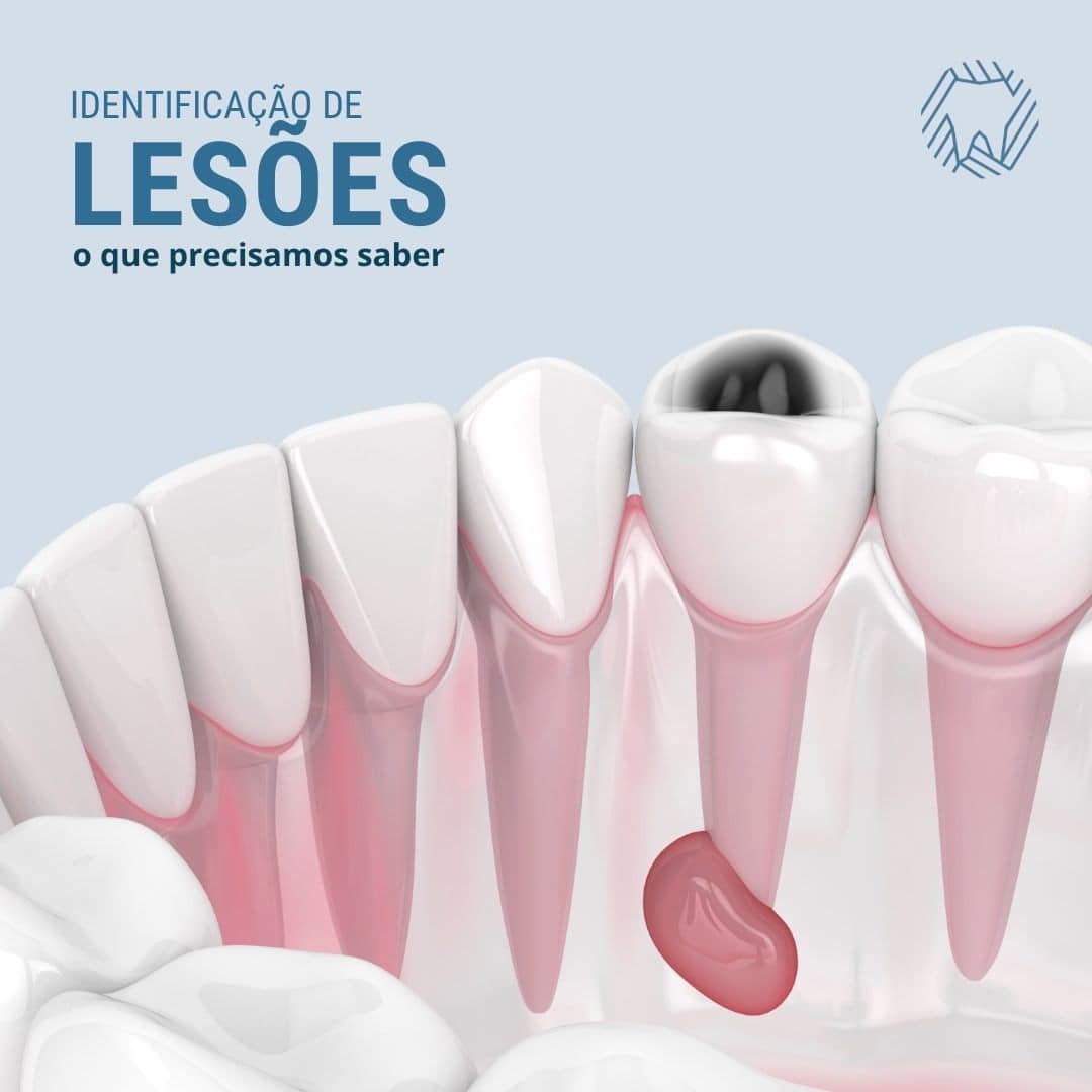 identificacao-de-lesoes