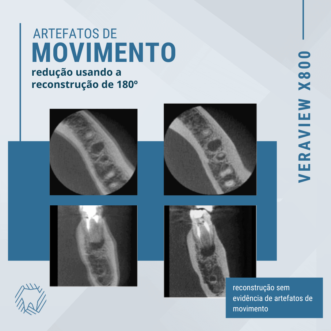 artefatos-metalicos