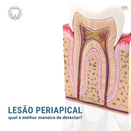 Ilustração da anatomia interna de um dente