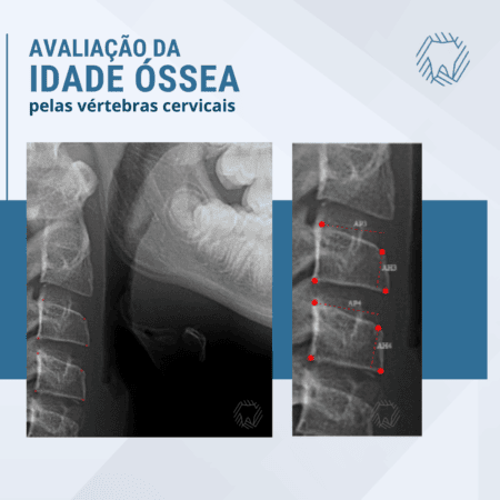 Telerradiografia mostrando as vértebras cervicais do paciente