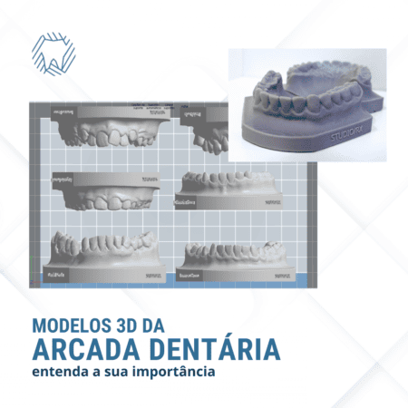Diversos modelos 3D de arcadas dentárias